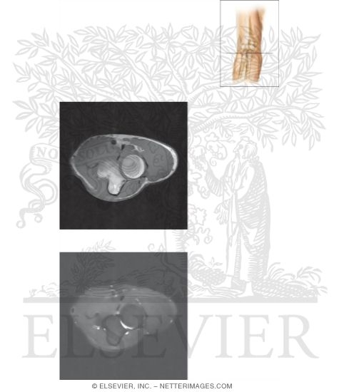 Cross Section of the Elbow: Axial View