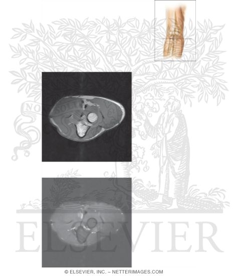 Cross Section of the Elbow: Axial View