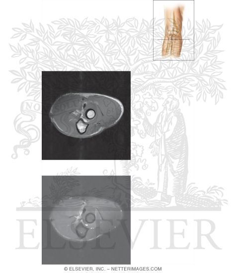Watermarked preview of unlabeled image: Cross Section of the Elbow: Axial View
