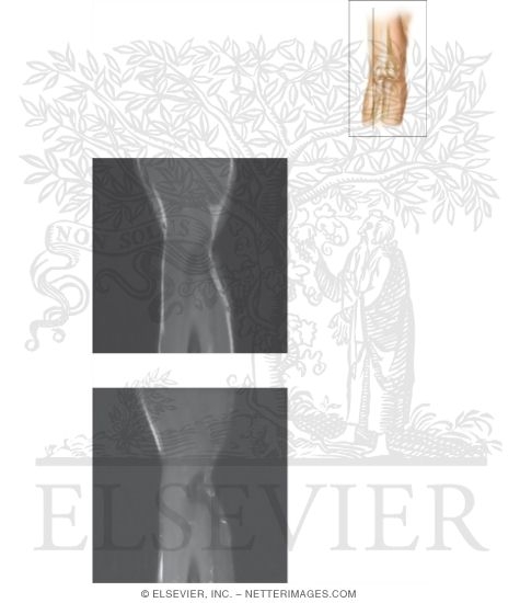 Watermarked preview of unlabeled image: Cross Section of the Elbow: Sagittal View