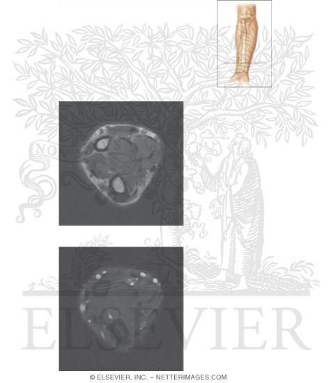 Cross Section of the Forearm: Axial View