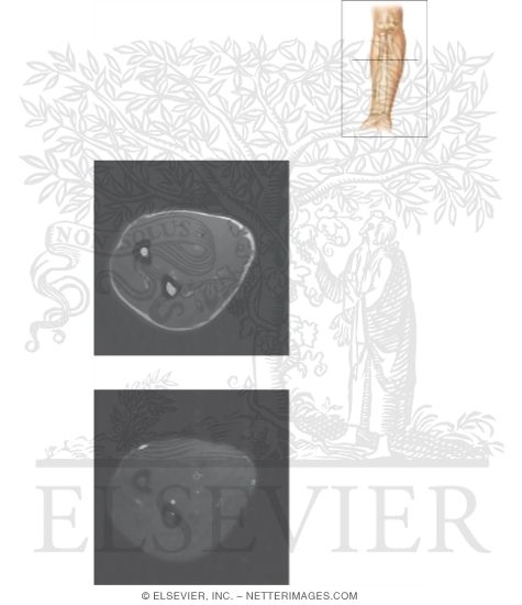 Cross Section of the Forearm: Axial View