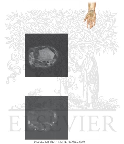 Watermarked preview of unlabeled image: Cross Section of the Wrist: Axial View