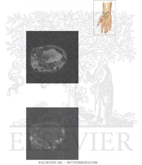 Watermarked preview of unlabeled image: Cross Section of the Wrist: Axial View
