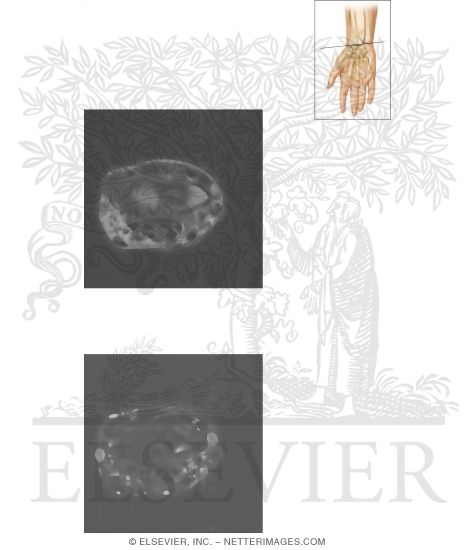 Watermarked preview of unlabeled image: Cross Section of the Wrist: Axial View