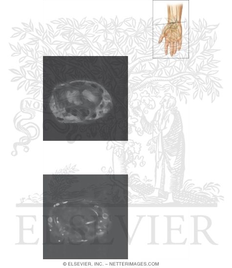 Cross Section of the Wrist: Axial View