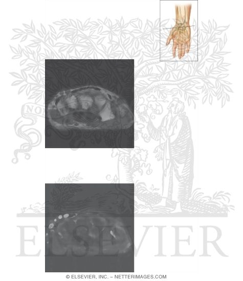 Watermarked preview of unlabeled image: Cross Section of the Wrist: Axial View