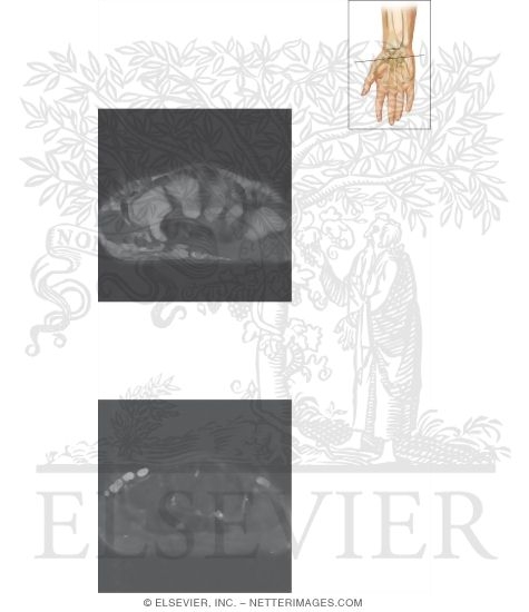 Watermarked preview of unlabeled image: Cross Section of the Wrist: Axial View