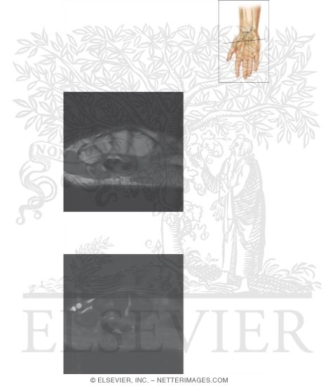 Watermarked preview of unlabeled image: Cross Section of the Wrist: Axial View
