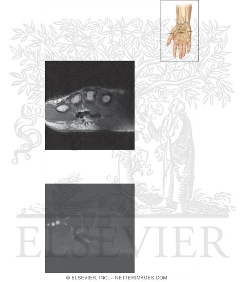 Watermarked preview of unlabeled image: Cross Section of the Wrist: Axial View
