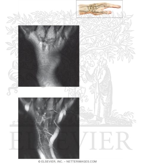 Watermarked preview of unlabeled image: Cross Section of the Wrist: Coronal View
