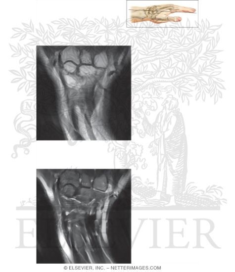 Watermarked preview of unlabeled image: Cross Section of the Wrist: Coronal View