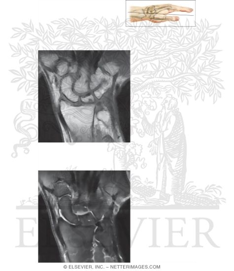 Watermarked preview of unlabeled image: Cross Section of the Wrist: Coronal View