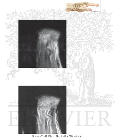 Watermarked preview of unlabeled image: Cross Section of the Wrist: Coronal View