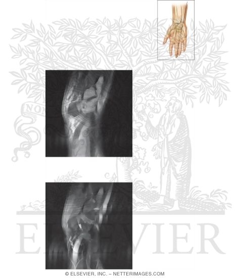 Watermarked preview of unlabeled image: Cross Section of the Wrist: Sagittal View
