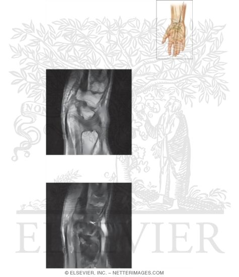 Watermarked preview of unlabeled image: Cross Section of the Wrist: Sagittal View