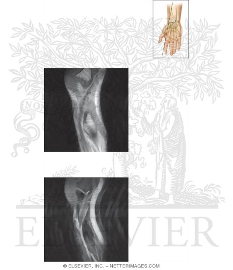Watermarked preview of unlabeled image: Cross Section of the Wrist: Sagittal View