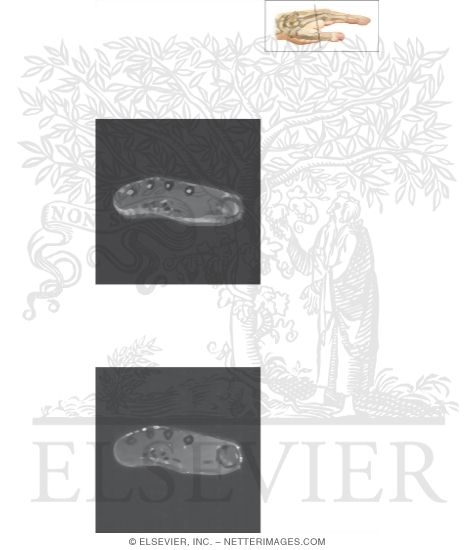 Watermarked preview of unlabeled image: Cross Section of the Hand: Axial View