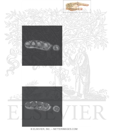 Watermarked preview of unlabeled image: Cross Section of the Hand: Axial View