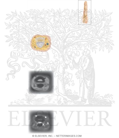 Watermarked preview of unlabeled image: Cross Section of the Finger: Axial View