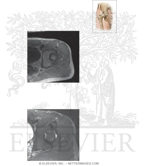 Watermarked preview of unlabeled image: Cross Section of the Hip: Axial View