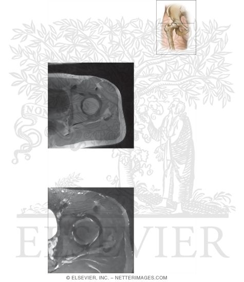Watermarked preview of unlabeled image: Cross Section of the Hip: Axial View