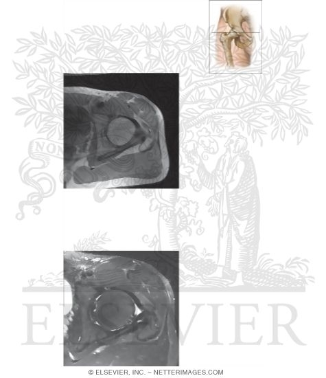 Watermarked preview of unlabeled image: Cross Section of the Hip: Axial View