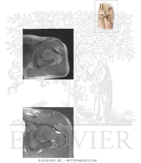 Watermarked preview of unlabeled image: Cross Section of the Hip: Axial View