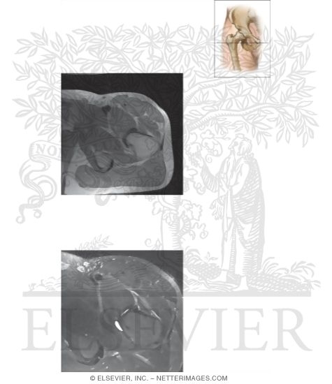 Watermarked preview of unlabeled image: Cross Section of the Hip: Axial View