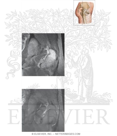 Watermarked preview of unlabeled image: Cross Section of the Hip: Coronal View
