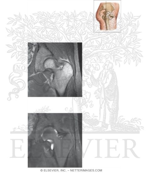 Watermarked preview of unlabeled image: Cross Section of the Hip: Coronal View