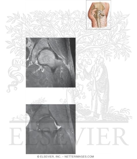 Watermarked preview of unlabeled image: Cross Section of the Hip: Coronal View