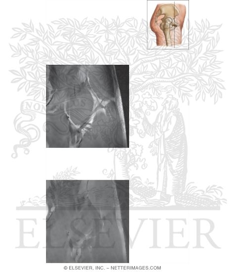Watermarked preview of unlabeled image: Cross Section of the Hip: Coronal View