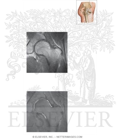 Watermarked preview of unlabeled image: Cross Section of the Hip: Coronal Oblique View