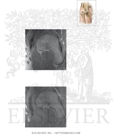 Watermarked preview of unlabeled image: Cross Section of the Hip: Sagittal View