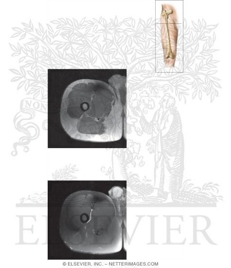 Watermarked preview of unlabeled image: Cross Section of the Thigh: Axial View