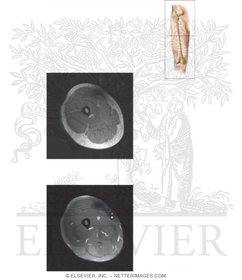 Watermarked preview of unlabeled image: Cross Section of the Thigh: Axial View