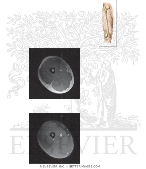 Watermarked preview of unlabeled image: Cross Section of the Thigh: Axial View