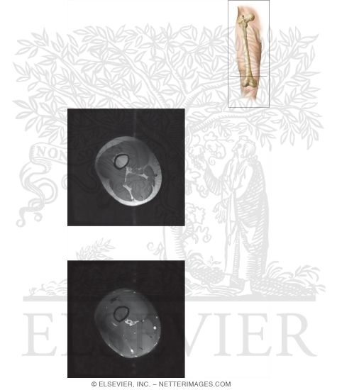 Watermarked preview of unlabeled image: Cross Section of the Thigh: Axial View