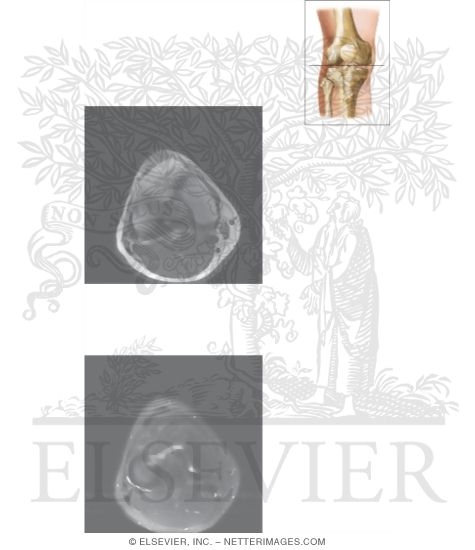 Cross Section of the Knee: Axial View