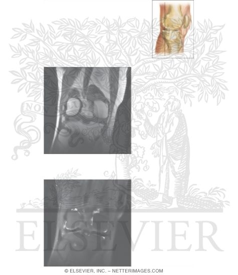Watermarked preview of unlabeled image: Cross Section of the Knee: Coronal View