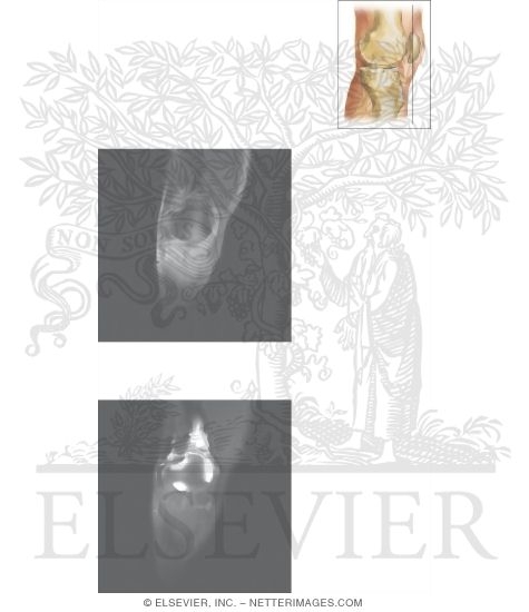 Watermarked preview of unlabeled image: Cross Section of the Knee: Coronal View