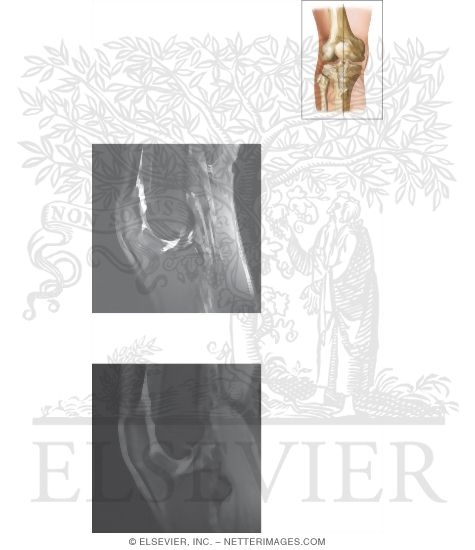 Watermarked preview of unlabeled image: Cross Section of the Knee: Sagittal View