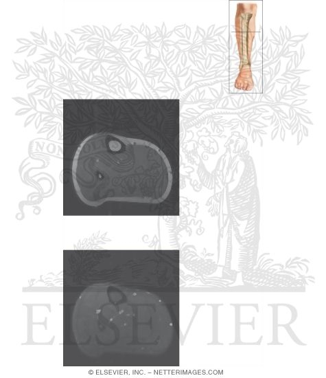 Watermarked preview of unlabeled image: Cross Section of the Lower Leg: Axial View