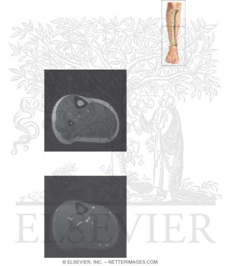 Watermarked preview of unlabeled image: Cross Section of the Lower Leg: Axial View
