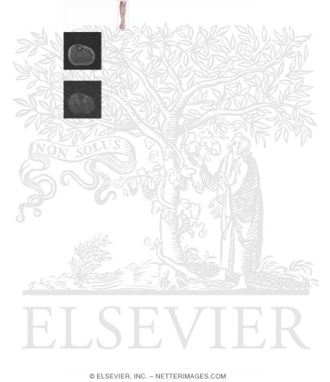 Watermarked preview of unlabeled image: Cross Section of the Lower Leg: Axial View