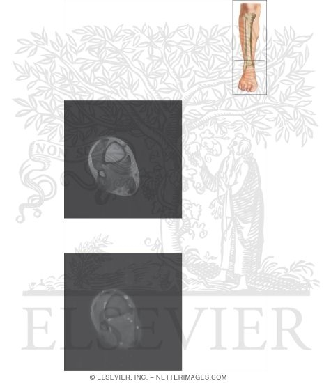 Watermarked preview of unlabeled image: Cross Section of the Lower Leg: Axial View