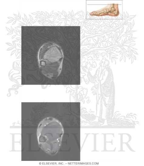 Watermarked preview of unlabeled image: Cross Section of the Ankle and Foot: Axial View
