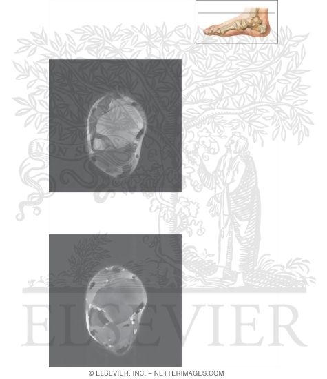 Watermarked preview of unlabeled image: Cross Section of the Ankle and Foot: Axial View