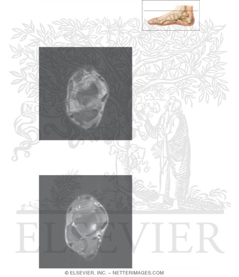 Watermarked preview of unlabeled image: Cross Section of the Ankle and Foot: Axial View